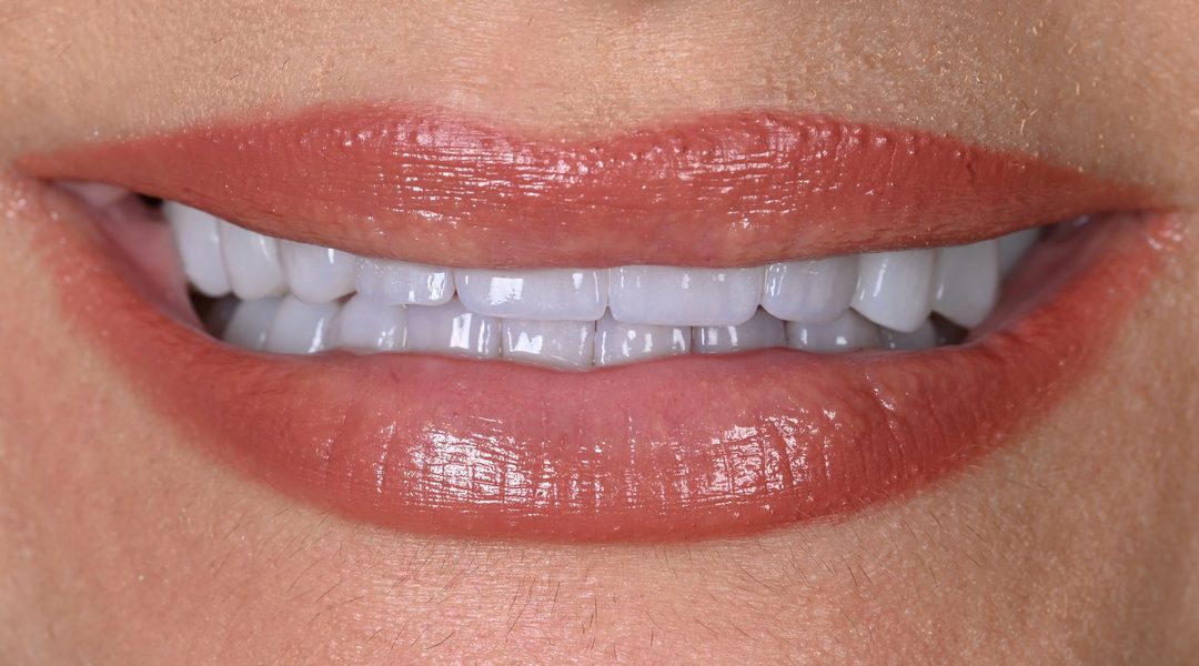 BLISS Dental Implant Centar