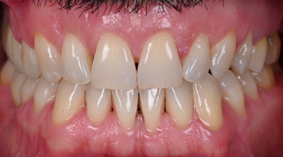 BLISS Dental Implant Centar